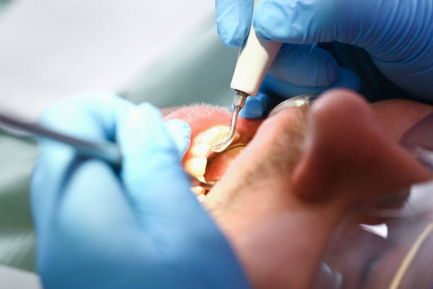 Best Pediatric Emergency Dentist in Homewood, IL