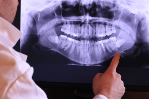 Best Orthodontic Emergency Dentist in Homewood, IL
